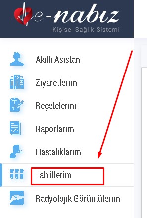 Sağlık Ocağı Kan Tahlil Sonucu